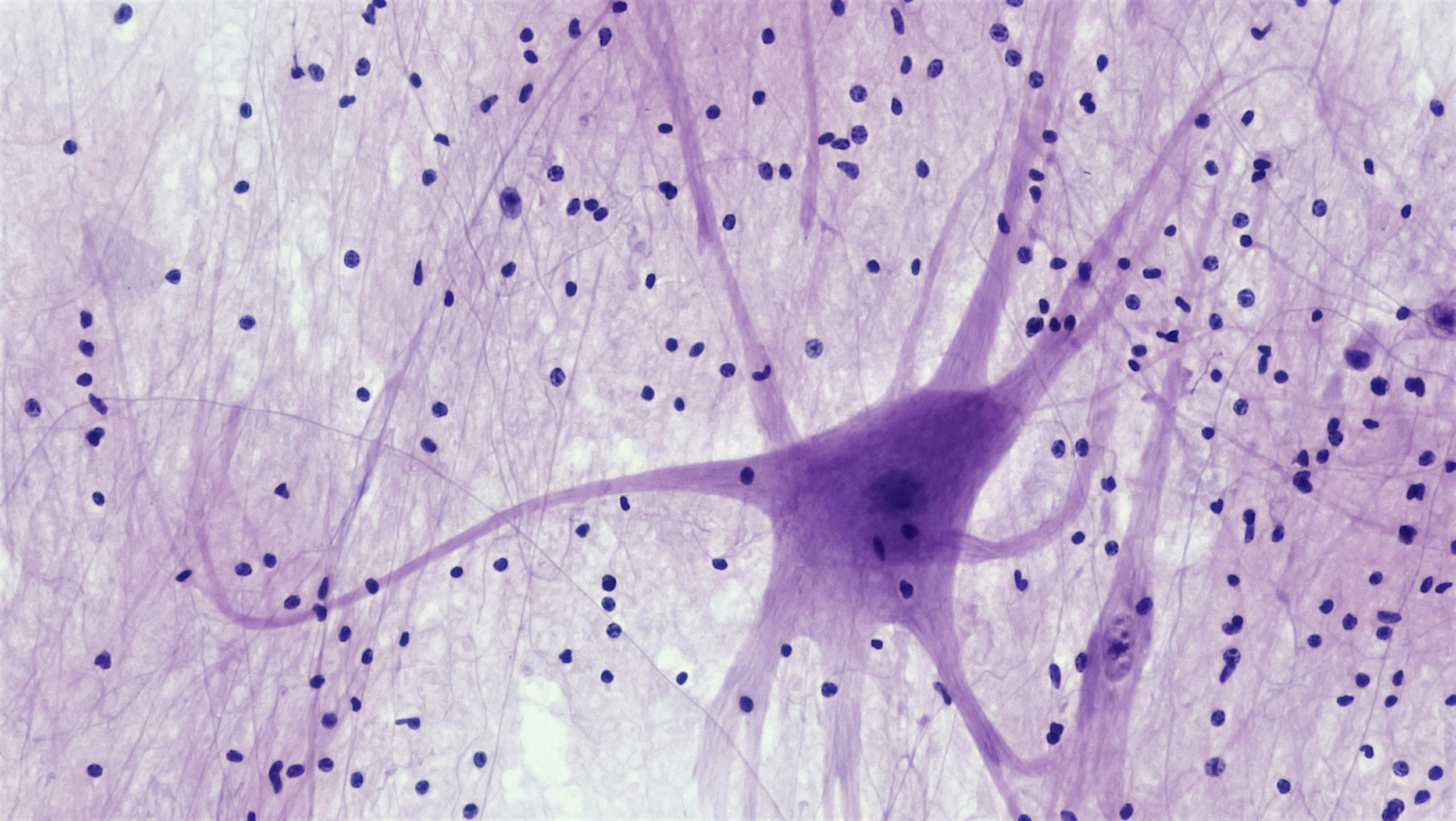 Vad passar bättre än en mikroskopbild av ett neuron för att illustrera en text om tankar om AI?